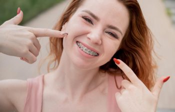 Pași esențiali după îndepărtarea aparatului dentar